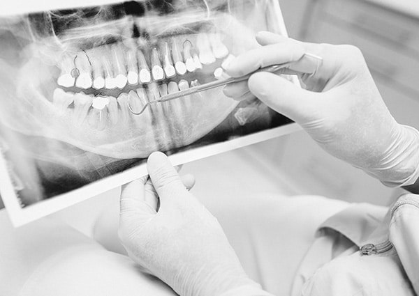 Metales en la boca: impacto en la salud bucal y alternativas biocompatibles en odontología funcional.