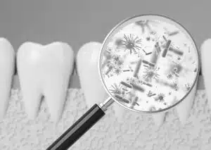 Ilustración del microbioma oral con bacterias beneficiosas y patógenas en la boca.