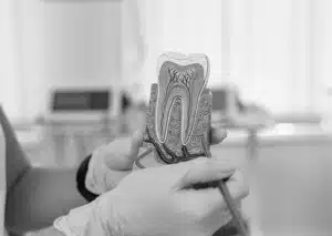 ¿Son seguras las endodoncias? Alternativas en odontología funcional con ozono y materiales biocompatibles.